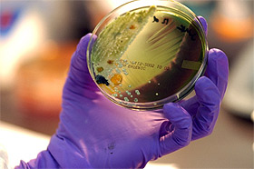 Picture of petri dish